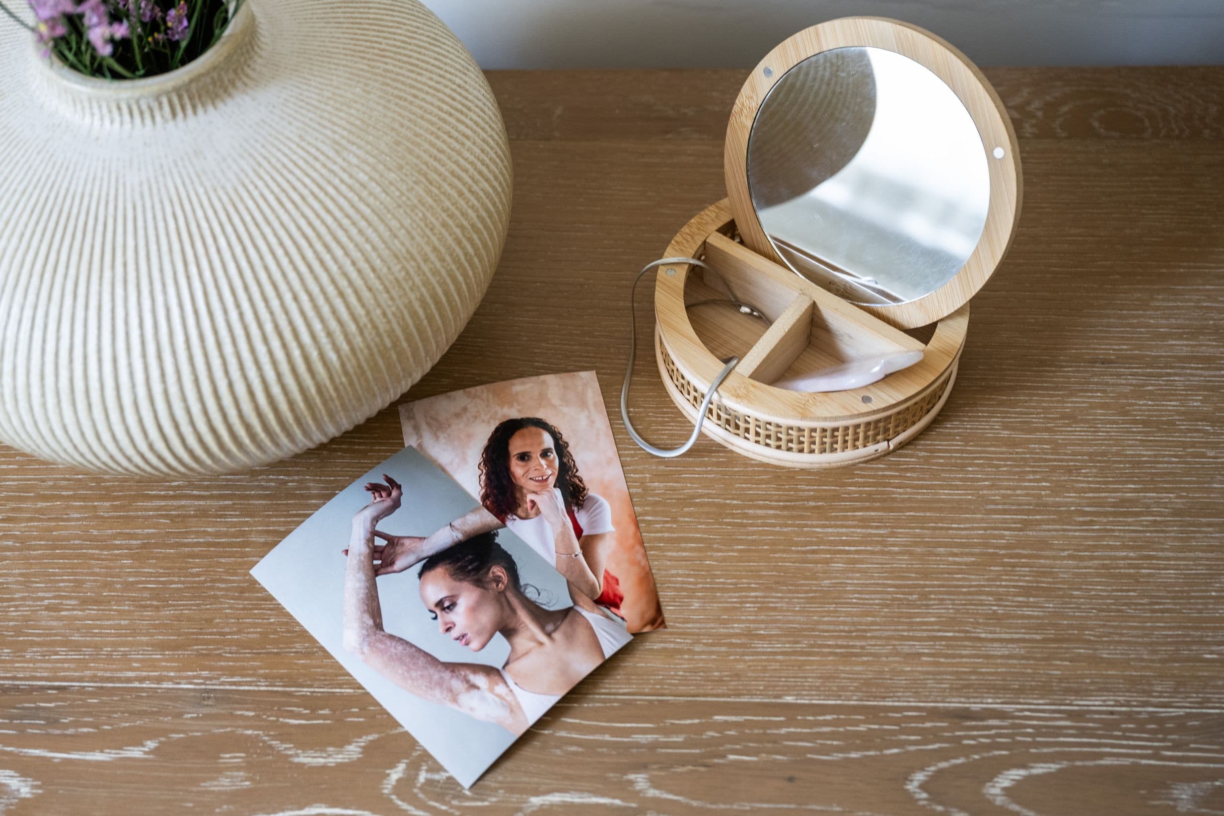 Two printed photos displayed on a table showing Natalie proudly displaying her vitiligo