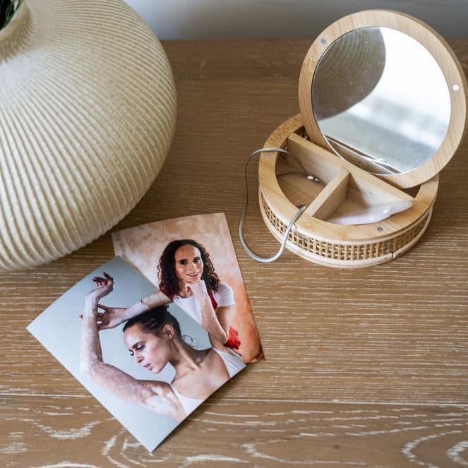 Two printed photos displayed on a table showing Natalie proudly displaying her vitiligo